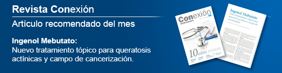 Novedades