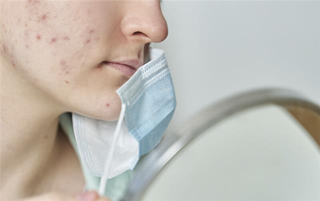 Manejo terapéutico del acné inflamatorio leve