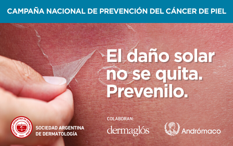 Image: 29° Campaña Nacional de Prevención del Cáncer de Piel